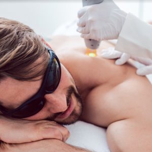 laserontharing-mannen-oudenaarde